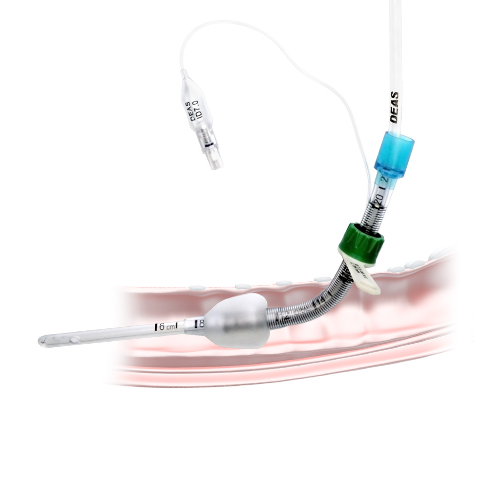 Tracheostomy tube exchange guide